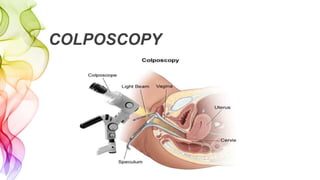 COLPOSCOPY
 