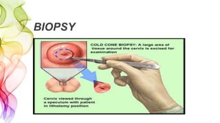 BIOPSY
 