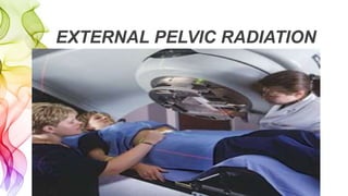 EXTERNAL PELVIC RADIATION
 