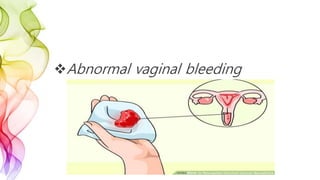 Abnormal vaginal bleeding
 
