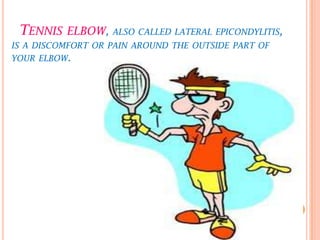 TENNIS ELBOW, ALSO CALLED LATERAL EPICONDYLITIS,
IS A DISCOMFORT OR PAIN AROUND THE OUTSIDE PART OF
YOUR ELBOW.
 