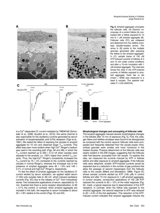 Amyloid-Induced Activity in Follicles
                                                                                                                       Jorge Parodi et al.


A                                                    B                                             Fig. 5. Amyloid aggregate uncouples
                                                                                                   the follicular cells. (A) Electron mi-
                                                                                                   croscopy of a control follicle (A) con-
                                                                                                   trasted with a follicle exposed for 15
                                                                                                   min to 1 µM amyloid aggregate (B).
                                                                                                   Follicular cells (FC) are collapsed
                                                                                                   and detached from the vitelline enve-
                                                                                                   lope (double-headed arrow). The
                                                                                                   arrow in (B) points to the multiple
                                                                                                   granules generated after exposing
                                                                                                   the follicle to the amyloid aggregate.
                                                                                                   In (C), sample traces of 100 µM
                                                                                                   ATP-induced currents of follicles at 0
                                                                                                   and 15 min under control conditions
                                                                                                   and after a 15-min incubation with 1
                                                                                                   µM amyloid aggregate. The inset plot
                                                                                                   shows the drop in the ATP-induced
                                                                                                   currents of follicles exposed to amy-
                                                                                                   loid aggregate. Each bar or dot
                                                                                                   (mean ± SEM) was measured in a
                                                                                                   least 6 oocytes. The asterisk indi-
                                                                                                   cates P < 0.05 (ANOVA).
 C




is a Ca2+-dependent Cl- current mediated by TMEM16A (Schro-          Morphological changes and uncoupling of follicular cells
eder et al., 2008; Scudieri et al., 2012); this same channel is      The amyloid aggregate induced several morphological changes
also responsible for the oscillatory currents generated by serum     in the follicles after 15 min of exposure (Fig. 5). First, the colla-
activation of lysophosphatidic acid (LPA) receptors (Tigyi et al.,   gen fibers and vitelline envelope were found to be disorganized
1991). We tested the effect of exposing the oocytes to amyloid       as compared with the control; second, follicular cells were com-
aggregate for 15 min and observed larger Tout currents. This         pacted and frequently detached from the oocyte proper; third,
effect was even more evident when high Ca2+ Ringer’s medium          cortical granules were smaller and more numerous in the
was used in the recording bath (Figs. 4A and 4B), in which the       treated oocytes. Physical detachment of the follicular cells was
Tout current reached up to 200 ± 0.12 nA when oocytes were           clearly evident in the EM images, suggesting that the follicular
exposed to the amyloid, i.e., 150% higher than control Tout cur-     cells had become uncoupled from the oocyte. To explore this
rents. Thus, the high-Ca2+ Ringer’s consistently increased the       idea, we measured the currents induced by ATP in follicles
Tout current by 75 ± 2% compared to the currents reached by          before and after exposure to amyloid aggregate. If the follicular
oocytes in normal Ringer’s, whereas the increases due to the         cells were detached, smaller ATP-induced currents would be
presence of amyloid aggregate were 48 ± 1.9% and 149 ±               expected due to a reduction in the number of gap junctions that
3.1%, in normal and high-Ca2+ Ringer’s, respectively.                allow the passage of second messengers from the follicular
   To test the effect of amyloid aggregate on the oscillatory Cl-    cells to the oocyte (Miledi and Woodward, 1989). Figure 5C
current elicited by serum activation, we applied rabbit serum        shows sample currents elicited by ATP (100 µM) in control
(1:100) onto oocytes held at -60 mV, which induced oscillatory       follicles and after 15 min exposure to 1 µM amyloid aggregate.
currents (Fig. 4C) due to the release of Ca2+ from intracellular     In control oocytes, consecutive applications of 100 µM ATP
stores. Two consecutive applications of serum, separated by 15       reduced the currents to 60 ± 12% of the initial response (Fig.
min, illustrate that there is some receptor desensitization, to 85   5C, inset), a typical response due to desensitization of the ATP
± 3.1% the control; in contrast, when amyloid aggregate are          receptors. In contrast, when the follicle was exposed to the
included in the bath, the response to serum increases to about       amyloid aggregate, the second response to ATP was reduced
50 ± 1.8% relative to the control (Figs. 4C and 4D).                 to 20 ± 4.3% of the first application. This reduction of the ATP-
                                                                     induced current indicates that amyloid aggregate induces the



http://molcells.org                                                                                                       Mol. Cells    353
 