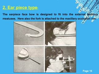 Powerpoint Templates
Page 16
2. Ear piece type:
The earpiece face bow is designed to fit into the external auditory
meatuses. Here also the fork is attached to the maxillary occlusion rim.
 