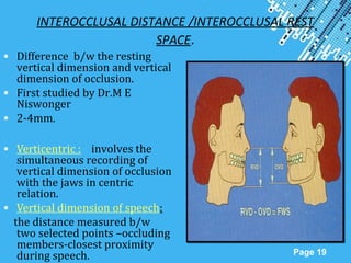 Powerpoint Templates
Page 19
INTEROCCLUSAL DISTANCE /INTEROCCLUSAL REST
SPACE.
• Difference b/w the resting
vertical dimension and vertical
dimension of occlusion.
• First studied by Dr.M E
Niswonger
• 2-4mm.
• Verticentric : involves the
simultaneous recording of
vertical dimension of occlusion
with the jaws in centric
relation.
• Vertical dimension of speech:
the distance measured b/w
two selected points –occluding
members-closest proximity
during speech.
 