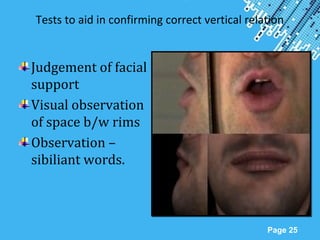 Powerpoint Templates
Page 25
Tests to aid in confirming correct vertical relation
Judgement of facial
support
Visual observation
of space b/w rims
Observation –
sibiliant words.
 