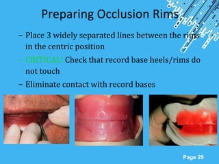 Powerpoint Templates
Page 29
Preparing Occlusion Rims
– Place 3 widely separated lines between the rims
in the centric position
– CRITICAL! Check that record base heels/rims do
not touch
– Eliminate contact with record bases
 