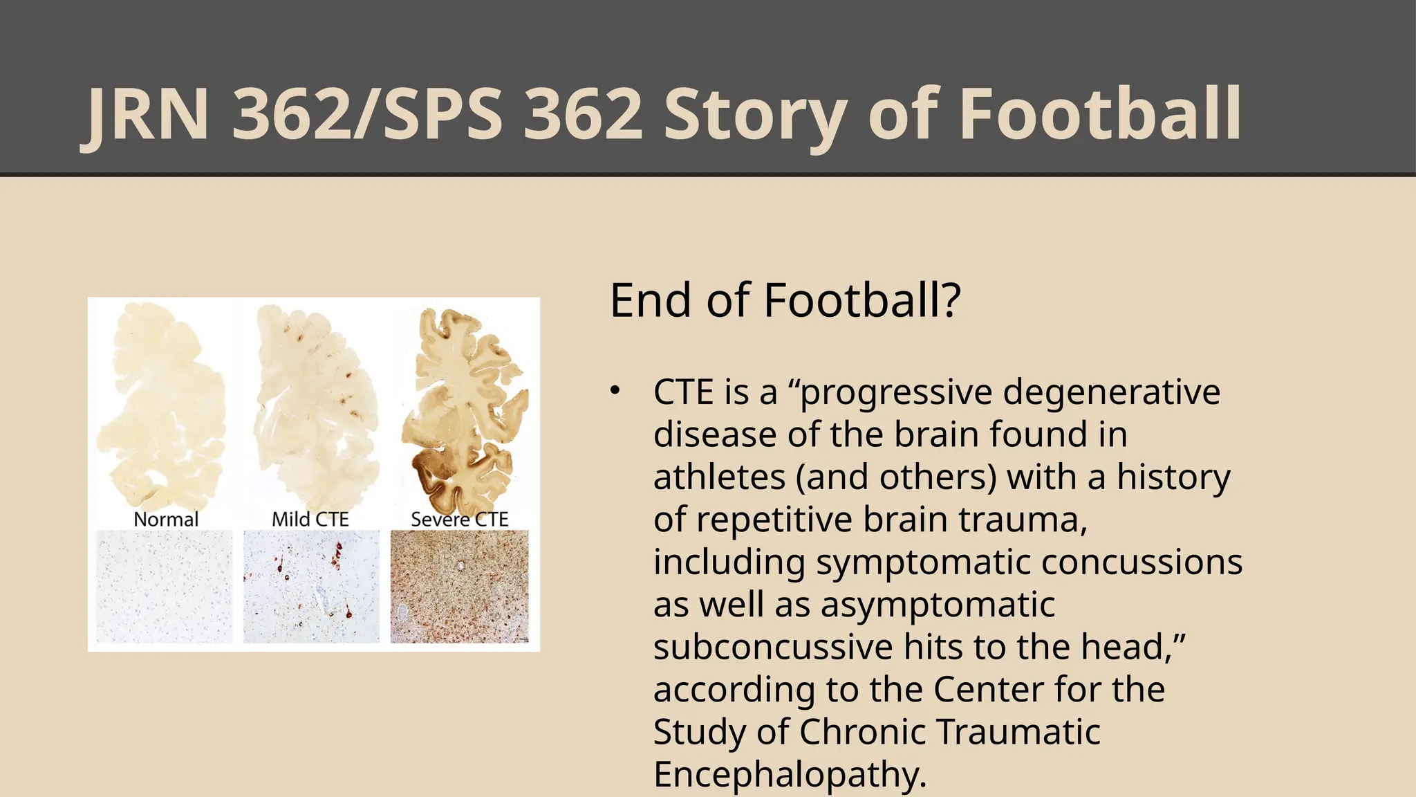 JRN 362/SPS 362 Story of Football
End of Football?
• CTE is a “progressive degenerative
disease of the brain found in
athletes (and others) with a history
of repetitive brain trauma,
including symptomatic concussions
as well as asymptomatic
subconcussive hits to the head,”
according to the Center for the
Study of Chronic Traumatic
Encephalopathy.
 