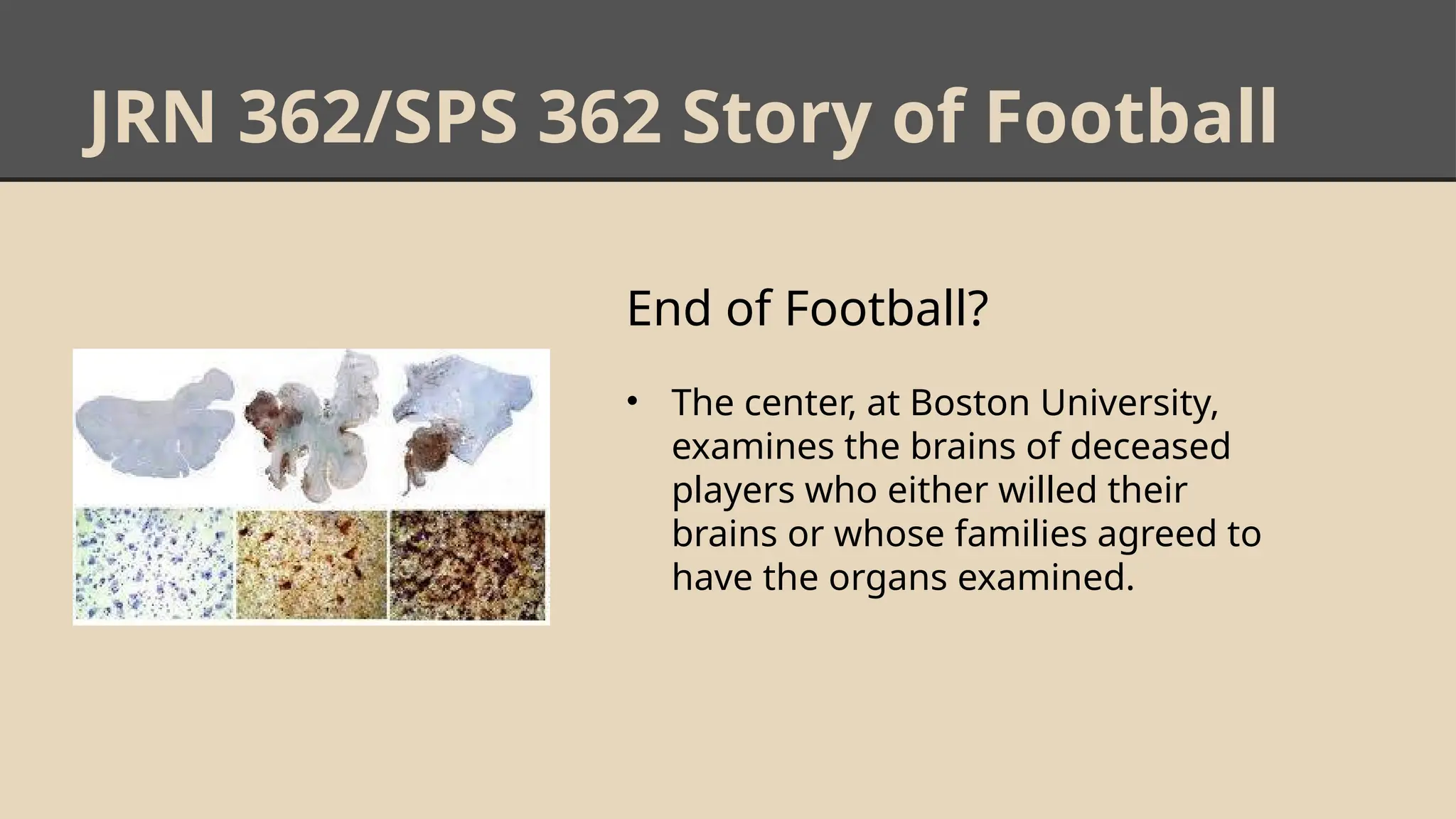 JRN 362/SPS 362 Story of Football
End of Football?
• The center, at Boston University,
examines the brains of deceased
players who either willed their
brains or whose families agreed to
have the organs examined.
 