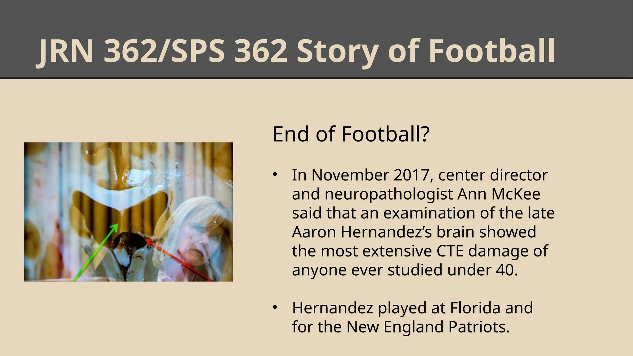 JRN 362/SPS 362 Story of Football
End of Football?
• In November 2017, center director
and neuropathologist Ann McKee
said that an examination of the late
Aaron Hernandez’s brain showed
the most extensive CTE damage of
anyone ever studied under 40.
• Hernandez played at Florida and
for the New England Patriots.
 