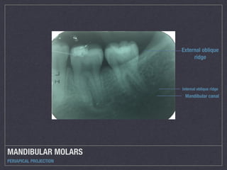 Oblique Ridge Radiography Roentgenology | PDF