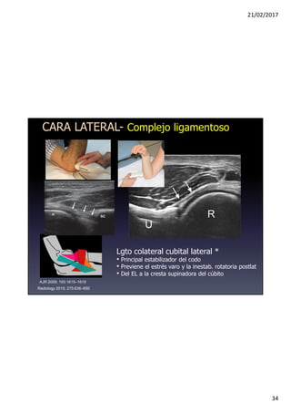 21/02/2017
34
Lgto colateral cubital lateral *
• Principal estabilizador del codo
• Previene el estrés varo y la inestab. rotatoria postlat
• Del EL a la cresta supinadora del cúbito
Radiology 2015; 275:636–650
AJR 2009; 193:1615–1619
CARA LATERAL- Complejo ligamentoso
 