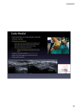 21/02/2017
36
• Posición del paciente con el codo extendido o flexionado
y antebrazo supinado.
• Estudiaremos principalmente
– Tendón Flexór común (TFC): Formado por Flexor radial del carpo,
Palmar largo, Flexor cubital del carpo y Flexor superficial de los
dedos. Menor longitud que el Tendón extensor común.
– Banda anterior del ligamento lateral interno
• Si flexionamos el codo 90 grados se produce una alineación óptima y vemos el
patrónfibrilar. A veces multifibrilar por interposición de grasa, no confundir con
patología.
• Landmark o referenta anatómico: Epicóndilo medial:
Imagen lineal hiperecogénica de contornos lisos con
sombra acústica posterior
Codo Medial
Banda anterior del LLI
Epicóndilo medial
Epicóndilo medial
TFC
Tubérculo sublime
de la coronoides
 