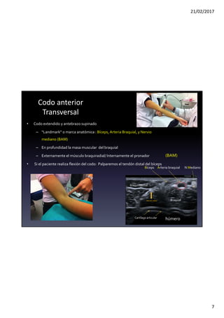 21/02/2017
7
Codo anterior
Transversal
• Codo extendido y antebrazo supinado
– “Landmark” o marca anatómica : Bíceps, Arteria Braquial, y Nervio
mediano (BAM)
– En profundidad la masa muscular del braquial
– Externamente el músculo braquiradial/ Internamente el pronador
• Si el paciente realiza flexión del codo: Palparemos el tendón distal del bíceps
Braquial
braquiorradial
Bíceps
húmero
Nervio radial
Arteria braquial N Mediano
(BAM)
Cartílago articular
 