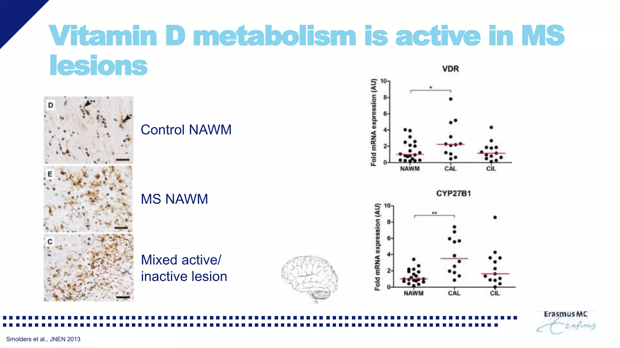 Vitamin D metabolism is active in MS
lesions
MS NAWM
Control NAWM
Mixed active/
inactive lesion
Smolders et al., JNEN 2013
 