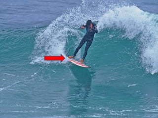 Les Pathologies des Pieds du Surfeur