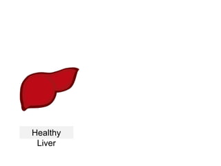 Healthy
Liver
 