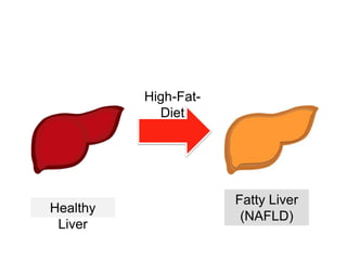 Healthy
Liver
Fatty Liver
(NAFLD)
High-Fat-
Diet
 