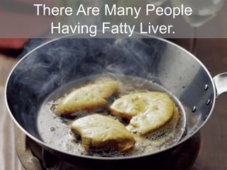 There Are Many People
Having Fatty Liver.
 