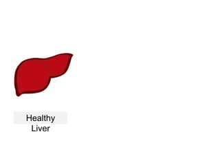 Healthy
Liver
 