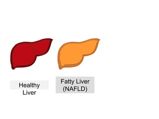 Healthy
Liver
Fatty Liver
(NAFLD)
 