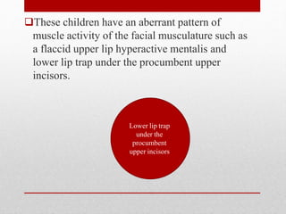 These children have an aberrant pattern of
muscle activity of the facial musculature such as
a flaccid upper lip hyperactive mentalis and
lower lip trap under the procumbent upper
incisors.
Lower lip trap
under the
procumbent
upper incisors
 