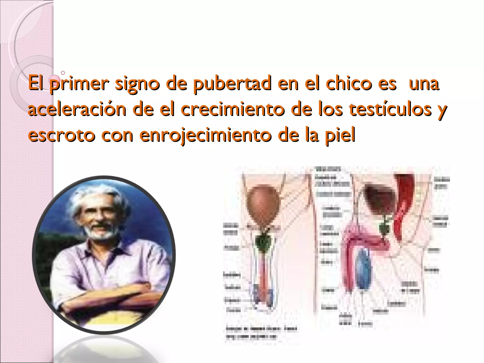 El primer signo de pubertad en el chico es  una aceleración de el crecimiento de los testículos y escroto con enrojecimiento de la piel 