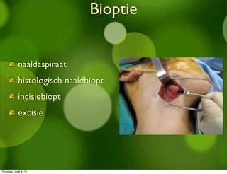 Bioptie
naaldaspiraat
histologisch naaldbiopt
incisiebiopt
excisie
Thursday, June 6, 13
 