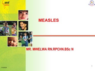 1/16/2024
MEASLES
MR. MWELWA RN.RPCHN.BSc N
1
 