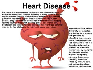 Heart Disease
The connection between dental hygiene and heart disease is a well-
known one; researchers from the University of Bristol in the UK and the
Royal College of Surgeons in Dublin found that people with bleeding
gums from poor dental hygiene were at an increased risk of heart
disease. They saw that heart disease risk increased because bacteria
from the mouth of people with bleeding gums is able to enter the
bloodstream and stick to platelets, which can then form blood clots that
interrupt the ﬂow of blood to the heart and trigger a heart attack.
Researchers from Bristol
University investigated
how the bacteria interact
with platelets by
mimicking the pressure
inside the blood vessels
and heart, and found that
these bacteria use the
platelets as a defense
mechanism; by clumping
the platelets together,
they can completely
surround themselves,
shielding them from
attack by immune cells
and making them less
detectable to antibiotics.
 
