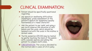 CLINICAL EXAMINATION:
 Patient should be specifically questioned
regarding:
 any speech or swallowing difficulties
(dysphagia), gross assessment of the
patient’s speech for dysphonia (usually
hoarseness) or a ‘nasal character’.
 Ask the patient to say ‘aahh’ and using a
pen torch observe the elevation of soft
palate and the uvula, which should be
symmetrical with the uvula in the midline in
normal cases.
 Tactile sensation (CN IX) may be tested
by gently touching the back of the palate
with a wooden spatula and asking the
patient to compare both sides.
 OBESERVATION: The uvula is deviated to
the normal side in cases of CN X palsy.
 