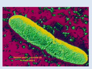 Yersinia pestis, causante de
la peste negra
 