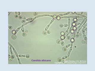 Candida albicans
 