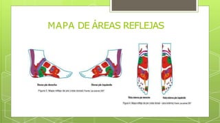 MAPA DE ÁREAS REFLEJAS
 