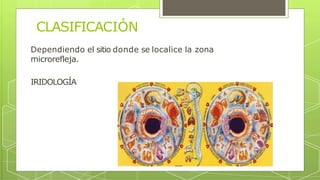 CLASIFICACIÓN
Dependiendo el sitio donde se localice la zona
microrefleja.
IRIDOLOGÍA
 