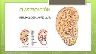 REFLEXOLOGIA AURICULAR
CLASIFICACIÓN
 