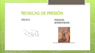 TECNICAS DE PRESIÓN
ORUGA PRESION
I
NTERMIT
ENTE
 