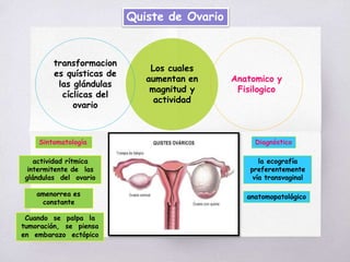 Los cuales
aumentan en
magnitud y
actividad
transformacion
es quísticas de
las glándulas
cíclicas del
ovario
Anatomico y
Fisilogico
Quiste de Ovario
Sintomatología Diagnóstico
actividad rítmica
intermitente de las
glándulas del ovario
amenorrea es
constante
Cuando se palpa la
tumoración, se piensa
en embarazo ectópico
la ecografía
preferentemente
vía transvaginal
anatomopatológico
 