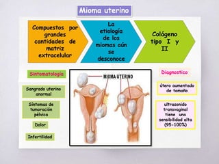 Mioma uterino
Compuestos por
grandes
cantidades de
matriz
extracelular
La
etiología
de los
miomas aún
se
desconoce
Colágeno
tipo I y
II
Sintomatología Diagnostico
Sangrado uterino
anormal
Síntomas de
tumoración
pélvica
Dolor
Infertilidad
útero aumentado
de tamaño
ultrasonido
transvaginal
tiene una
sensibilidad alta
(95-100%)
 
