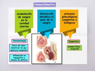 Hematómetra
acumulación
de sangre
en la
cavidad
uterina
obstrucción
mecánica al
paso de la
sangre
procesos
ginecológicos
congénitos o
biológicos
Sintomatología
Inicio del dolor
menstrual sin que
aparezca sangrado
inflamación en
hipogastrio y
deseos de defecar
Diagnostico
examen físico
ecografía
 