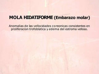 MOLA HIDATIFORME (Embarazo molar)
Anomalias de las vellocidades coreonicas consistentes en
proliferacion trofoblatica y edema del estroma velloso.
 