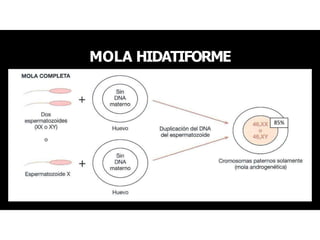 MOLA HIDATIFORME
85%
 