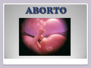 ABORTO
 