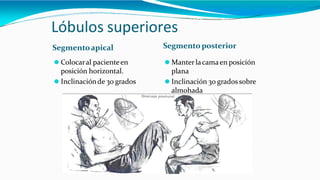 Lóbulos superiores
Segmentoapical
⚫ Colocaral pacienteen
posición horizontal.
⚫ Inclinaciónde 30 grados
Segmento posterior
⚫ Manterlacamaen posición
plana
⚫ Inclinación 30 grados sobre
almohada
 