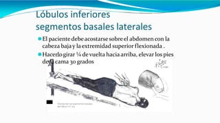 Lóbulos inferiores
segmentos basales laterales
⚫El paciente debeacostarsesobreel abdomen con la
cabeza bajay laextremidad superior flexionada .
⚫Hacerlogirar ¼ devuelta hacia arriba, elevar los pies
de lacama 30 grados
 