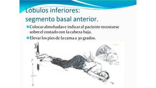 Lóbulos inferiores:
segmento basal anterior.
⚫Colocaralmohadase indicaral paciente recostarse
sobreel costadocon lacabeza baja.
⚫Elevar los pies de lacamaa 30 grados.
 