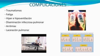 COMPLICACIONES
◦ Traumatismos
◦ Fatiga
◦ Híper e hipoventilación
◦ Diseminación infecciosa pulmonar
◦ Arritmias
◦ Laceración pulmonar
 