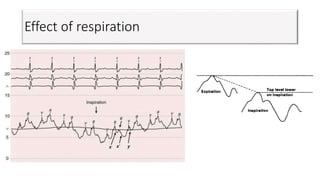 Effect of respiration
 
