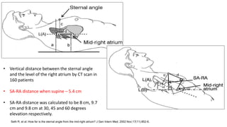 Seth R, et al. How far is the sternal angle from the mid-right atrium? J Gen Intern Med. 2002 Nov;17(11):852-6.
• Vertical distance between the sternal angle
and the level of the right atrium by CT scan in
160 patients
• SA-RA distance when supine – 5.4 cm
• SA-RA distance was calculated to be 8 cm, 9.7
cm and 9.8 cm at 30, 45 and 60 degrees
elevation respectively.
 