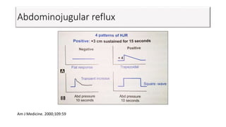 Abdominojugular reflux
Am J Medicine. 2000;109:59
 