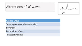Alterations of ‘a’ wave
Giant a wave
Severe pulmonary hypertension
Severe PS
Bernheim’s effect
Tricuspid stenosis
 